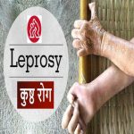 कोढ़, कुष्ठ (Leprosy) रोग के कारण,लक्षण और 15 प्राकृतिक उपचार (Leprosy Symptoms, Causes and 15 Natural Remedies in hindi)