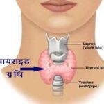 थायराइड (Thyroid) रोग के लक्षण, निदान और उपचार के 5 विकल्प! (Thyroid disease symptoms, diagnosis and 5 important treatment options in Hindi)