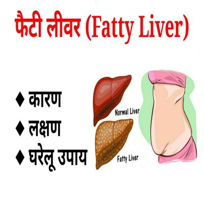 फैटी लिवर (Fatty Liver) रोग के कारण और इसका इलाज कैसे करें