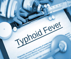 टाइफाइड बुखार के लक्षण और इससे बचने के 5 घरेलू उपाय (Symptoms of Typhoid fever and 5 important home remedies to avoid it in HIndi)