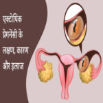 एक्टोपिक प्रेगनेंसी: कारण, लक्षण और उपचार के 2 विकल्प! (Ectopic Pregnancy: Causes, Symptoms and 2 important Treatment Options in Hindi)