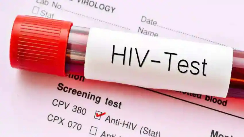 HIV Testing or Diagnosis