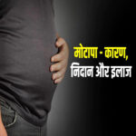 मोटापा: संकेत, लक्षण, और जटिलताएं (Obesity: Signs, Symptoms, and Complications in Hindi)