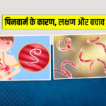 आंतों के कीड़े (Pinworms): कारण, निदान और उपचार! (Intestinal Worms (Pinworms): Causes, Diagnosis & important Treatment in Hindi)