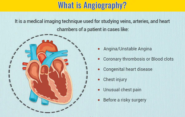 कोरोनरी एंजियोग्राफी क्या है? (What is Coronary Angiography?)