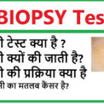 बायोप्सी (Biopsy) टेस्ट क्यों और कैसे किया जाता है? इसके 5 प्रकार के बारे जाने! (Why and how is the Biopsy test done? Know about its 5 important types in Hindi)