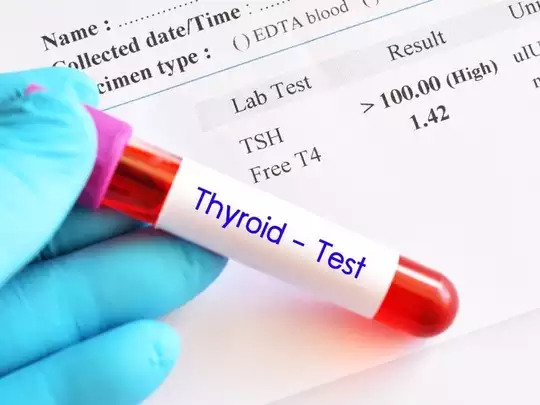 TSH Test (Thyroid Test ) क्या है, और इसको क्यों कराया जाता है? (What is TSH Test (Thyroid Test), and why is it done in Hindi?)